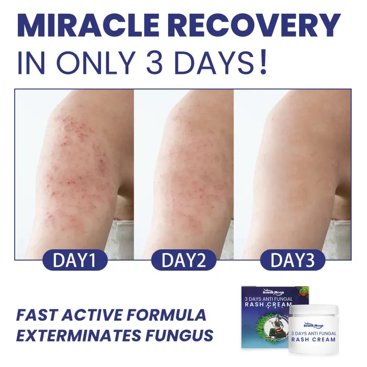 Eczema%20Treatment%20Cream%20Dermatitis%20Anti%20Itching%20Inhibit%20Fungi%20Urticaria%20Infection%20Prevent%20Hand%20Tinea%20Allergy%20Rash%20Repair%20Ointment%20-%20Image%203