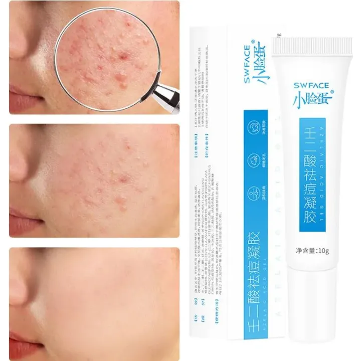 Azelaic%20Acid%20Acne%20Cream%20Remove%20Acnes%20Pimples%20Whiten%20Dark%20Spot%20Scars%20Anti%20Acne%20Treatment%20Gel%20Shrink%20Pores%20Oil%20Control%20Face%20Care%20-%20Image%202