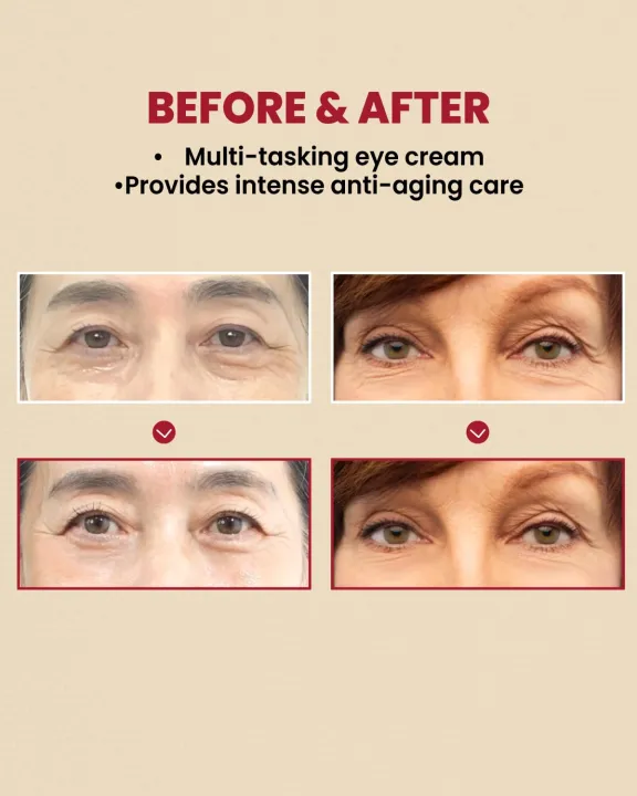 K-SECRET%20Seoul%201988%20Eye%20Cream%20Retinal%20Liposome%204%25%20+%20Fermented%20Bean%2030ml%20-%20Image%206