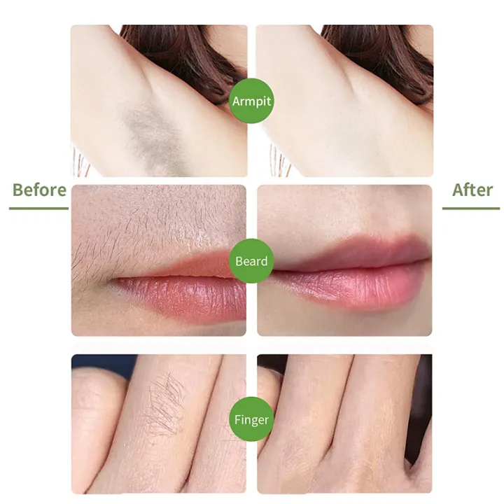 Olive%20Hair%20Removal%20Wax%20Strip%20Female%20Hair%20Removal%20Gentle%20And%20Fast%20Removal%20of%20Eyebrows%20Lips%20and%20Body%20Hair%2030PCS%20-%20Image%202