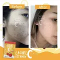 60 capsules LACHEL VITAMIN C Prevent Skin Aging. 