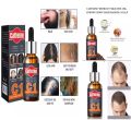 Caffeine Hair Essential Oil Anti Hair loss/ Control Hair Loss-30ml (cheo). 