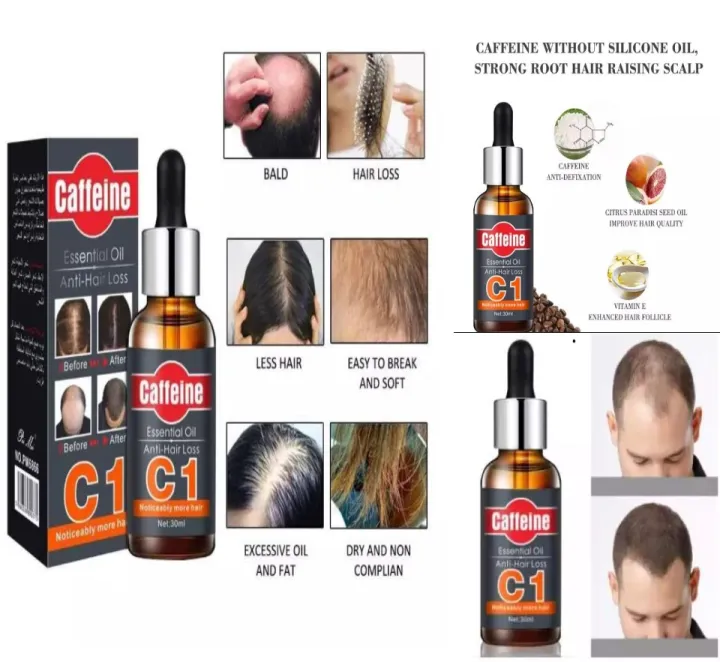 Caffeine%20Hair%20Essential%20Oil%20Anti%20Hair%20loss/%20Control%20Hair%20Loss-30ml%20(cheo)%20-%20Image%2010