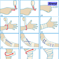 Sirend 1 Roll Nonwovens Elestic Bandages for First Aid Wound Dressing Bandage Tape Sports Protection Bandages 4 Specification Patch. 