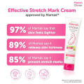 Mama's Choice Stretch Mark Lotion Cream (100ml) & Serum (50ml) Halal, Natural Maternity Skincare For Pregnant Moms SAB (FROM MALAYSIA). 