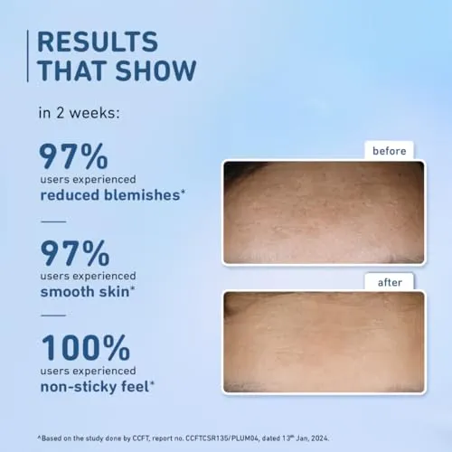 Plum%2010%25%20Niacinamide%20Serum%20with%20Rice%20Water%20%7C%20Provides%20Clear,%20Glowing%20&%20Brightening%20Skin%20%7C%20for%20Acne%20Prone,%20Combination,%20Oily%20&%20Sensitive%20Skin%20%7C%20Oil%20Control%20&%20Anti%20Acne%20Face%20Serum%20for%20Women%20&%20Men%20%7C%2015ml%20%20(FROM%20INDIA)%20-%20Image%204