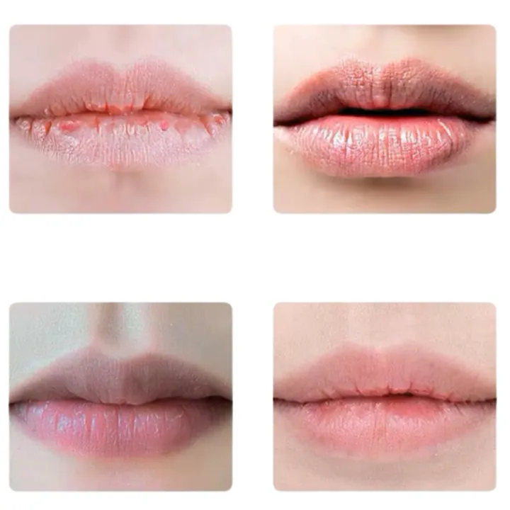 BIOAQUA%20Vitamin%20E%20Honey%20Lip%20Balm%20%E2%80%93%20Hydrating%20&%20Nourishing%20for%20Soft,%20Smooth%20Lips%20%7C%20Natural%20Ingredients%20with%20Plant%20Squalane%20&%20Glycerin%20%7C%20Hypoallergenic%20&%20All-Skin%20Types%20-%20Image%202