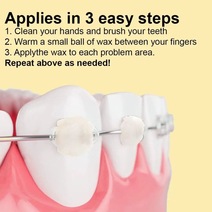 NEW%206%20Pack%20Braces%20Wax,Dental%20Wax%20for%20Braces%20Aligners,%20Unscented%20Flavorless%20-%2030%20Premium%20Orthodontic%20Wax%20Strips%20-%20Image%204