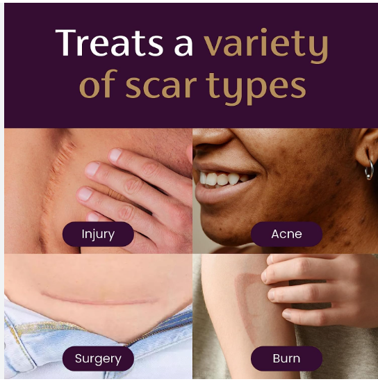 Mederma%20Skincare%20Scar%20Gel%20%7C%20For%20Scars%20Resulting%20from%20Injury,%20Burns,%20Surgery,%20Acne%20&%20Cut%20Marks%20-%20Image%203