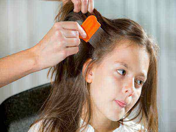 Lice%20Terminator%20Removes%20Dandruff%20Hair%20Comb%20Magic%20Soyod%20COD%20-%20Image%202