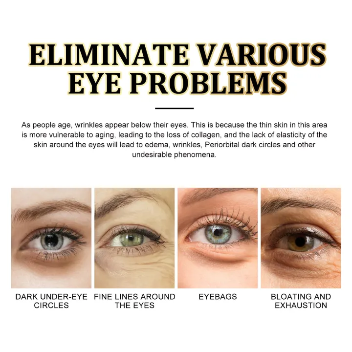 Collagen%20Gold%20Eye%20Mask%20Remove%20Dark%20Circle%20Anti%20Aging%20Puffiness%20Eye%20Bag%20Removal%20Fade%20Wrinkle%20Fine%20Line%20Moisturizing%20Eye%20Patches%20-%20Image%203
