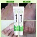 1-6pcs Foot Odor Beriberi Ointment Fungus Inhibitor Cream Feet Anti-itch Treat Psoriasis Athlete Foot Peeling Remove Tinea Pedis. 