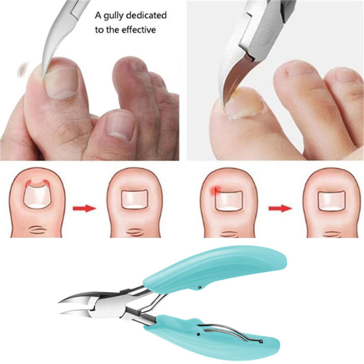 MTSSII%20Nail%20Cutter%20Cuticle%20Nippers%20Profesional%20Ingrown%20Toenail%20Scissors%20Dead%20Skin%20Removal%20Stainless%20Steel%20Nail%20Clipper%20Pedicure%20Tool%20-%20Image%204