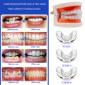Orthodontic Braces Dental Braces Smile Teeth Alignment Trainer Instanted Silicone Teeth Retainer Mouth Guard Braces Tooth Tray. 