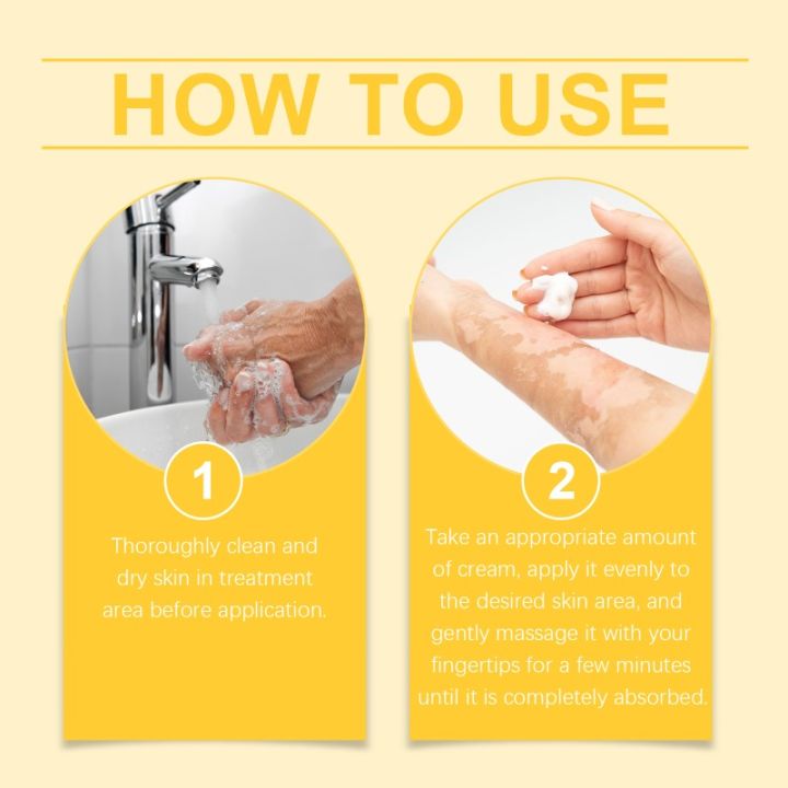 Bee%20Venom%20Vitiligo%20Treatment%20Cream%20Natural%20Relief%20Skin%20Treatment%20Soothing%20White%20Spot%20Removal%20Vitiligo%20Ointment%20Eliminate%20Pigment%20-%20Image%205