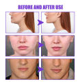 30g V-Shape Slimming Cream Removal Double Chin Firming Face-lift Slimming Masseter Muscle Face Fat Burning Anti-aging Products. 