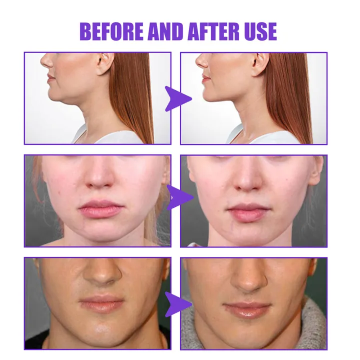 30g%20V-Shape%20Slimming%20Cream%20Removal%20Double%20Chin%20Firming%20Face-lift%20Slimming%20Masseter%20Muscle%20Face%20Fat%20Burning%20Anti-aging%20Products%20-%20Image%204