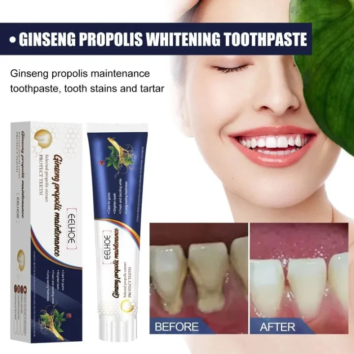 Teeth%20White%20Toothpast%20Cleaning%20Tooth%20Stains%20Fresh%20Oral%20Odor%20Bad%20Breath%20Protection%20Gum%20Bleeding%20Care%20Removal%20Yellow%20Toothpaste%20-%20Image%202