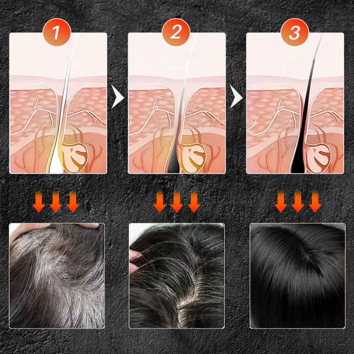 Hair%20Darkening%20Shampoo%20Bar%20for%20Gray%20Hair%20Coverage%20Soap%20Polygonum%20Multiflorum%20Fast%20Effective%20Repair%20Gray%20White%20Color%20Dye%20For%20Men%20-%20Image%204