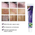 【Fast-selling】 Sumifun 1pcs Skin Care Psoriasis Ointment Treatment Dermatitis Eczema Chinese Herbal Antibacterial Cream Anti Patch.