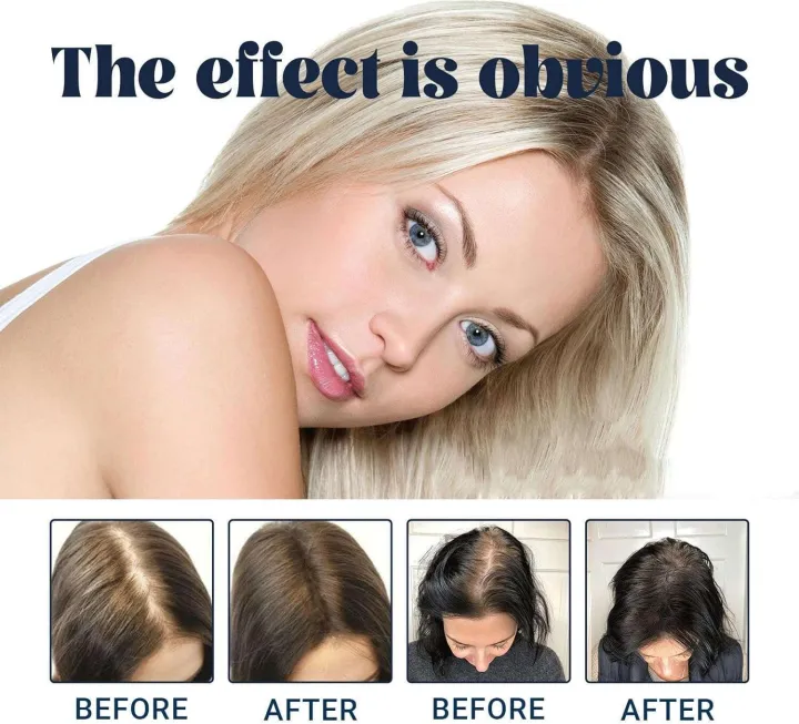 Fujiko%20Pon%20Dry%20Shampoo,%20Fluffy%20Powder%20for%20Lazy%20People,%20No-Wash,%20Refreshing%20-%20Image%205