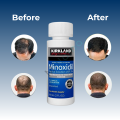 Kirkland Signature Minoxidil 5% Topical Solution for Hair & Beard Growth – 1 Month Supply + Premium Dropper – USA Imported. 