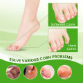 Foot Corn Remover Cream Chicken Eye Skin Infection Treatment Ointment Feet Dead Skin Calluses Removal Tool Health Care 내성발톱. 
