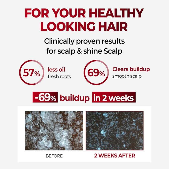 KUNDAL%20Anti%20Hair%20Loss%20&%20Hair%20Fall%20Control%20Caffeine%20Shampoo%20500ml%20-%20All%20Hair%20Types%20(White%20Musk)%20-%20Image%203