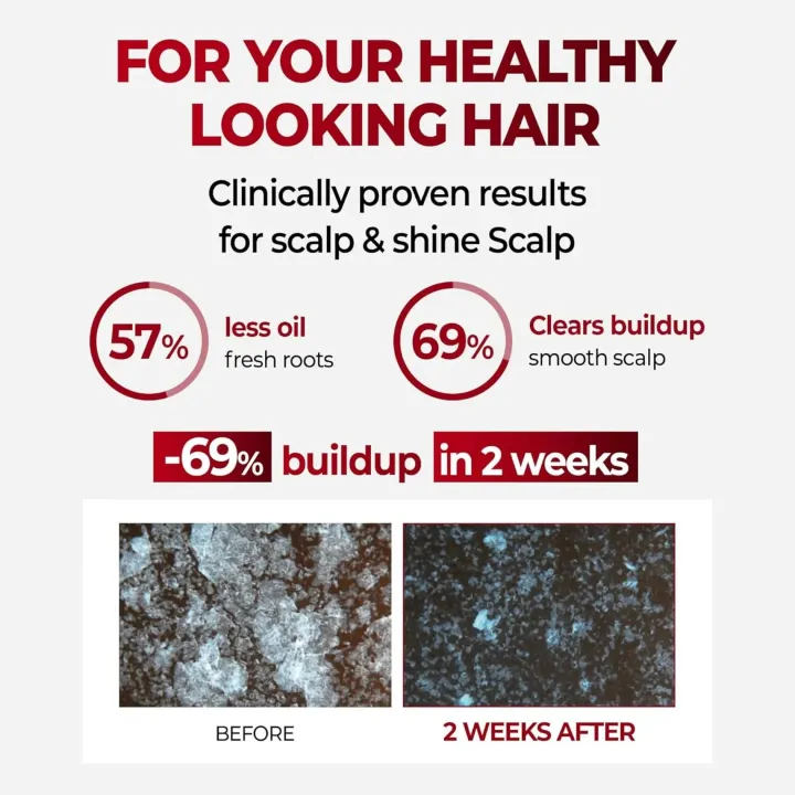 KUNDAL%20Anti%20Hair%20Loss%20&%20Hair%20Fall%20Control%20Caffeine%20Shampoo%20500ml%20-%20All%20Hair%20Types%20(White%20Musk)%20-%20Image%203