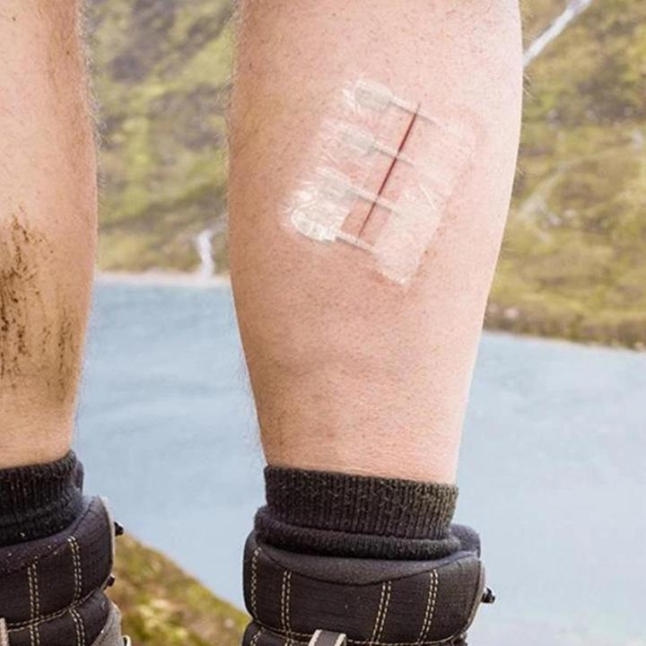 Suture-free%20Band-Aid%20Wound%20Painless%20Suture%20Adhesive%20Wound%20Closure%20Band%20Aid%20Fast%20Suture%20Zipper%20Band-Aid%20Outdoor%20Portable%20kit%20-%20Image%207