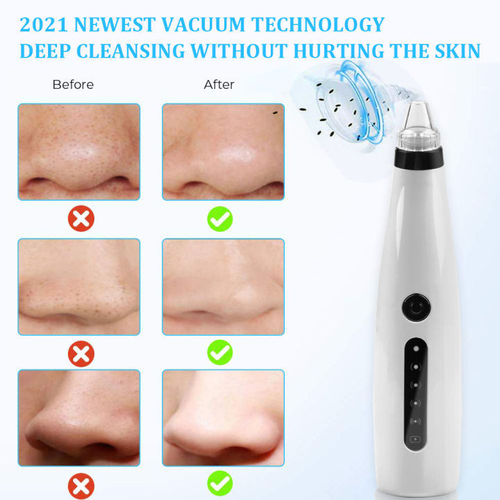 Weja%20Black%20Heads%20Remover%20Vacuum%20Facial%20Pore%20Vacuum%20Cleaner%20Electric%20USB%20Rechargeable%20-%20Image%204