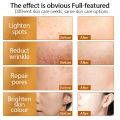 Professional Derma Roller Growth & Hair Regrowth Micro Needles Derma Roller Anti-Aging Skin Care Beauty Tool,Gold  Derma Roller REAL NEEDLES  Microneedles Dermaroller Micro Needle Roller Microneedling Derma Needling Kit. 