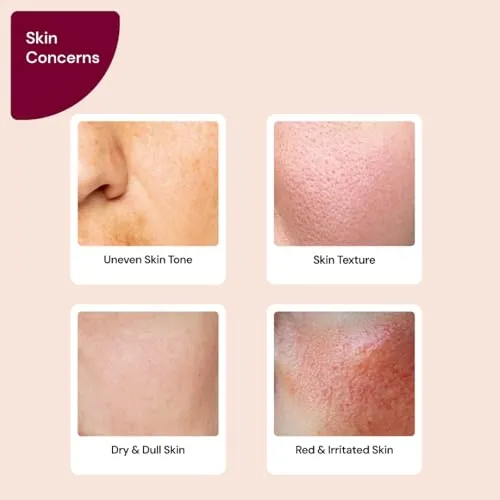 SUGANDA%205%25%20Lactic%20Acid%20Face%20Serum,%20AHA%20EXFOLIANT%20With%20HYALURONIC%20ACID%20AND%20GREEN%20TEA%20For%20GLOWING%20SKIN,REMOVES%20DEAD%20SKIN%20CELL,%20LIGHTENS,DARK%20SPOTS,CLEANSES%20PORES%2030ml,%20for%20men%20&%20women,%20Cruelty%20free(FROM%20INDIA)%20-%20Image%203