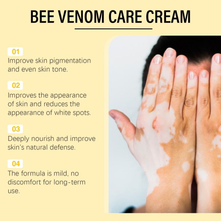 Bee%20Venom%20Vitiligo%20Treatment%20Cream%20Natural%20Relief%20Skin%20Treatment%20Soothing%20White%20Spot%20Removal%20Vitiligo%20Ointment%20Eliminate%20Pigment%20-%20Image%203