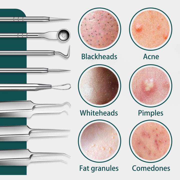 8PCS%20Blackhead%20Remover%20Kit,%20Comedone%20Pimple%20Extractor%20Tool%20Acne%20Removal%20Kit%20Acne%20Needle%20Blemish%20Remover%20Set%20for%20Blackhead,%20Whitehead%20Popping%20with%20Case%20-%20Image%203