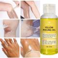 Yellow Peeling Oil Exfoliating Bleaching Dark Skin Spots Knee Finger Remove Dead Skin Melanin Whitening Brighten Body Skin Care. 