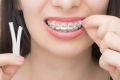 NEW 6 Pack Braces Wax,Dental Wax for Braces Aligners, Unscented Flavorless - 30 Premium Orthodontic Wax Strips. 