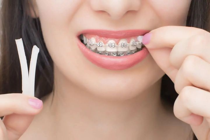 NEW%206%20Pack%20Braces%20Wax,Dental%20Wax%20for%20Braces%20Aligners,%20Unscented%20Flavorless%20-%2030%20Premium%20Orthodontic%20Wax%20Strips%20-%20Image%205