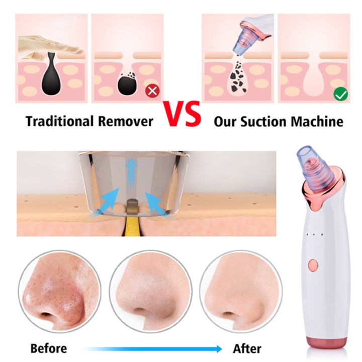 Electric%20Facial%20Blackhead%20Remover%20Vacuum%20Pore%20Cleaner%20Acne%20Cleanser%20Black%20Spots%20Removal%20Face%20Nose%20Deep%20Cleaning%20Tools%20-%20Image%206
