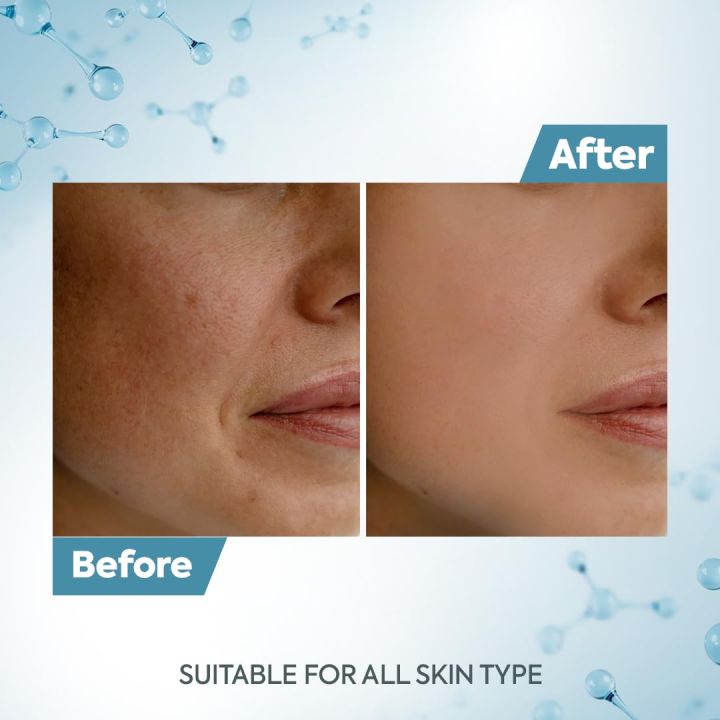 Raaga%20Professional%20De-Tan%20Tan%20removal%20Cream%2012G%20-%20Image%202