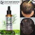 PURC Rosemary Oil Hair Growth Products for Man Women Ginger Anti Hair Loss Fast Regrowth Thicken Oils Scalp Treatment Hair Care. 