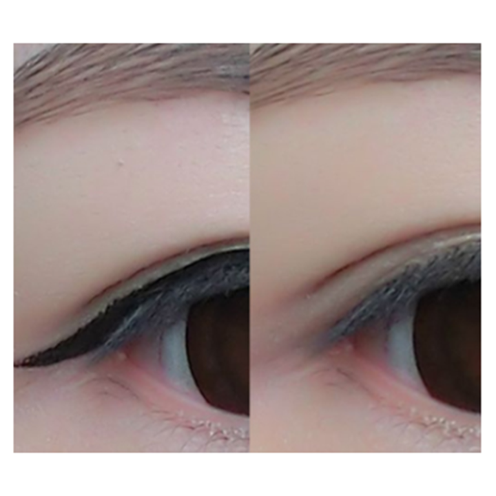 Permanent%20Tattoo%20Removal%20Cream%20Safe%20Removing%20Maximum%20Strength%20Cleaning%20-%20Image%203