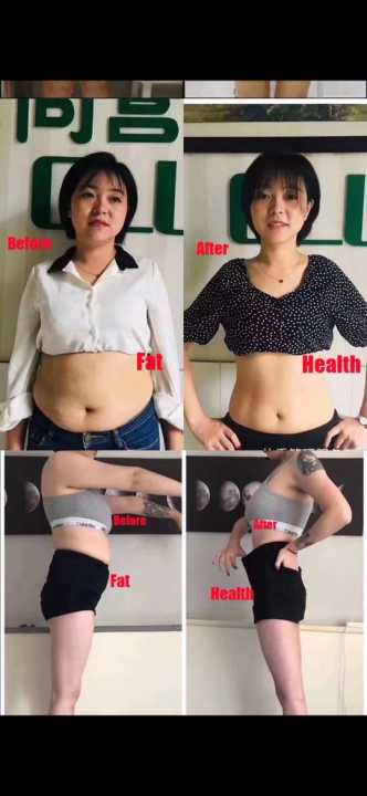 10Pcs%20Fast%20Weight%20Loss%20Slim%20Patch%20Burning%20Fat%20Belly%20Detox%20Stickers%20Strong%20Weight%20Loss%20Patch%20Slimming%20Stickers%20Slimming%20Product%20-%20Image%203