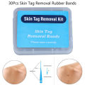 20pcs Skin Tag Removal Rubber Bands Micro Band Non Toxic Face Care Mole Wart Skin Care Tools. 