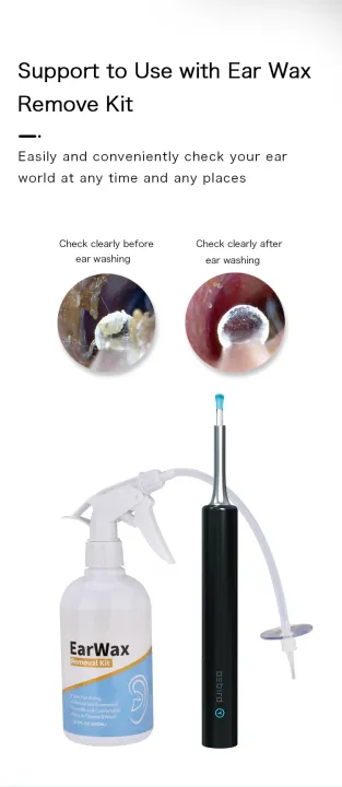 BEBIRD%20C3%20Ear%20Wax%20Removal%20Wireless%20Otoscope%20Tool%20Kit%20Ear%20Cleaner%20with%20Ear%20Camera%20%20Waterproof%20Digital%20Endoscope%20with%206%20LED%20Light%20%20Visual%20Ear%20Scope%20Camera%20Safe%20Ear%20Pick%20Ear%20Cleaning%20Tool%20with%20HD%20Camera%20for%20iPhone,%20iPad%20&%20Android%20Smart%20Phones%20-%20Image%205