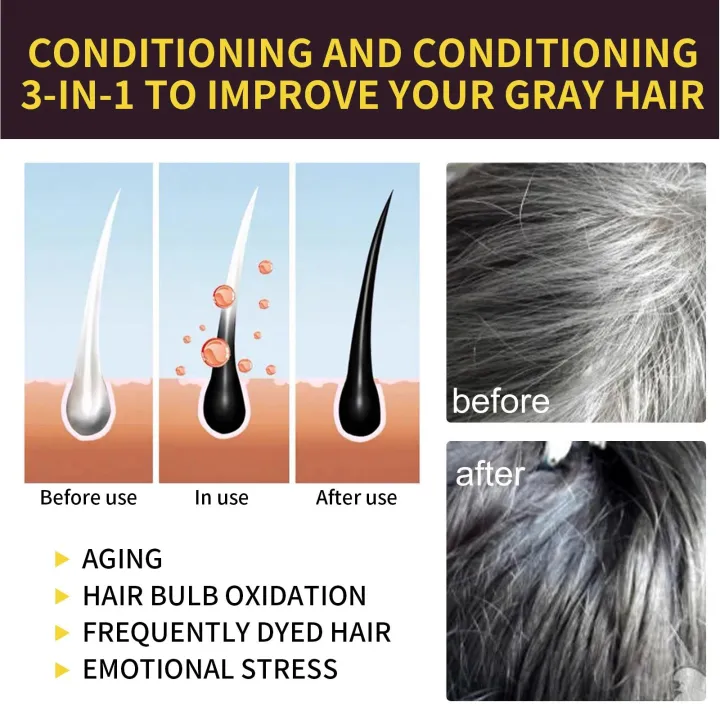 Black%20Hair%20Dye%20Shampoo%20White%20Hair%20Dye%20To%20Black%20Shampoo%20Activate%20Hair%20Follicle%20Melanin%20White%20Treatment%203%20In%201%20For%20Men%20Women%20-%20Image%204