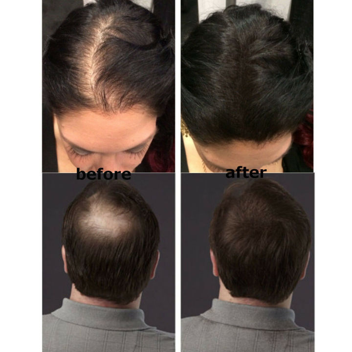 Dexe%20%20Original%20Black%20Colored%20Hair%20Building%20Fibers%20-%20Thickening%20Fiber%20for%20Women%20and%20Men%20-%20Hair%20Loss%20Concealer%20Powder%20for%20Thicker%20fiber%20Powder%20-%20Image%204