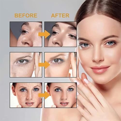 BOTOWI%20Saam%20Face%20Cream,%20Japanese%20Melasma%20Cream,%20Dr%20Hancy%20White%20Spot%20Cream%20China,%20Yunnan%20Herbal%20Whitening%20and%20Freckle-removing%20Cream,%20Saam%20Cosmetics%20Cream%20Dark%20Spots%20Cream,%20Dark%20Spot%20Corrector%20(1PCS)%20%20FROM%20DUBAI%20(SAM)%20-%20Image%202