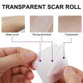 Scar tape, skin wound high-efficiency hand silicone sheet treatment patch, 4x15cm scar patch removal, ear orthosis skin burn repair. 