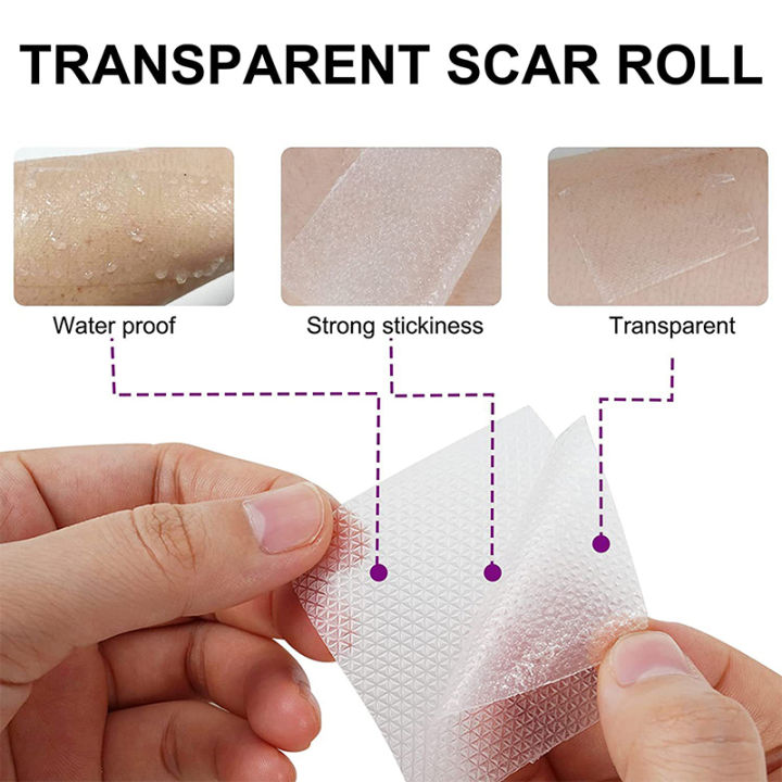 Scar%20tape,%20skin%20wound%20high-efficiency%20hand%20silicone%20sheet%20treatment%20patch,%204x15cm%20scar%20patch%20removal,%20ear%20orthosis%20skin%20burn%20repair%20-%20Image%205